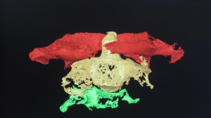 Scan showing the three remaining vertebrae of Worsley Man